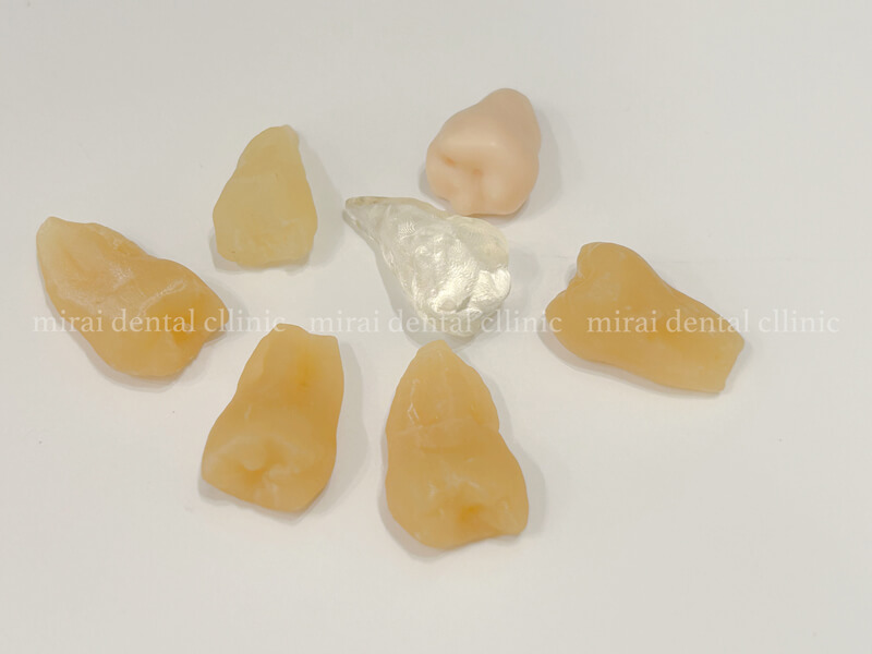 3D移植（歯の移植術・3D歯牙モデル使用）