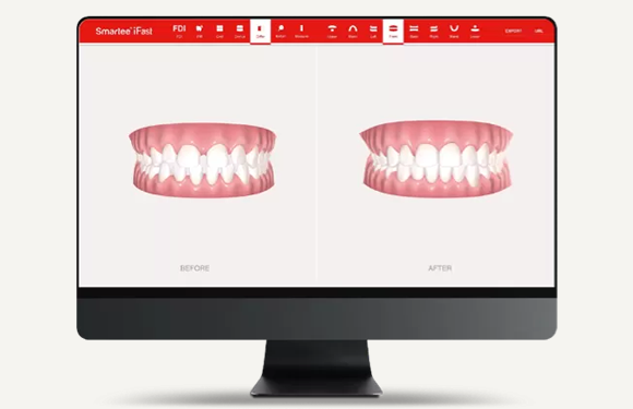 シミュレーション