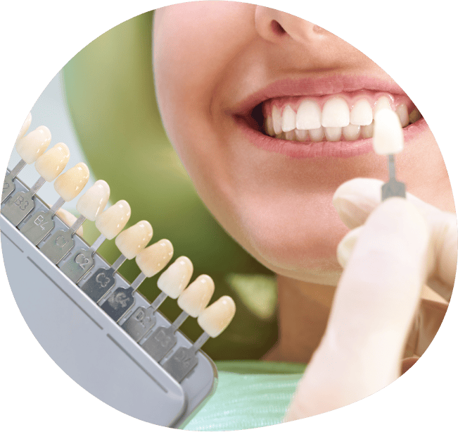 ホワイトニング