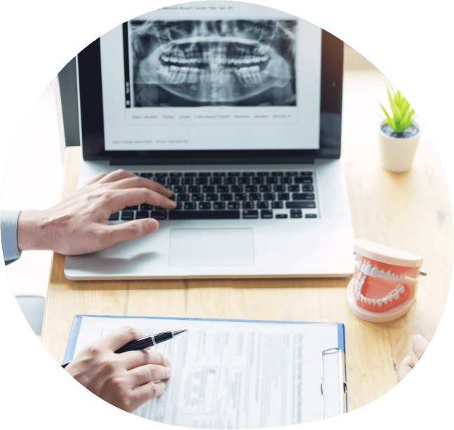 口腔外科インプラント